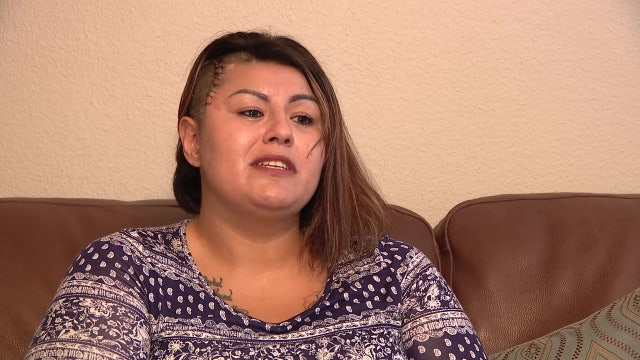 Mesa woman who was shot in the head by her ex-boyfriend speaks out about her recovery