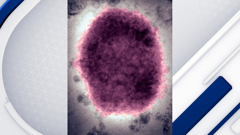 Monkeypox Virus (Photo By BSIP/UIG Via Getty Images)