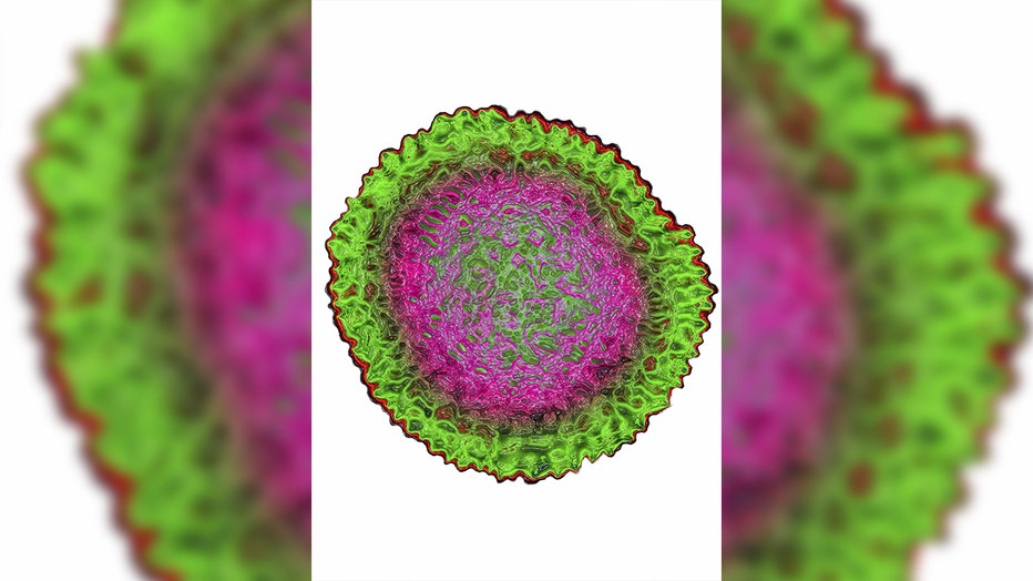 Avian Influenza Virus, Viral Diameter 100 Nm, The H5N1 Influenza Virus, Avian Influenza Strain, Causes A Severe Contagious Respiratory Infection. (Photo By BSIP/Universal Images Group via Getty Images)