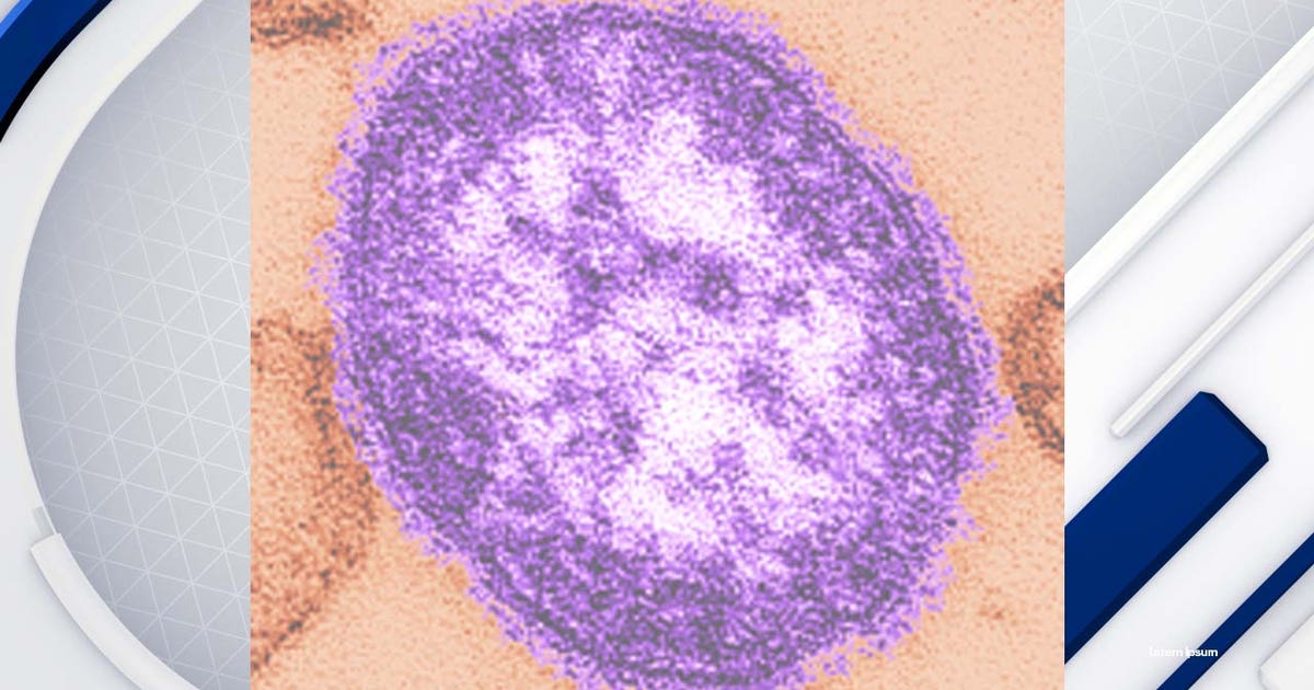 Coconino County resident tests positive for measles | FOX 10 Phoenix