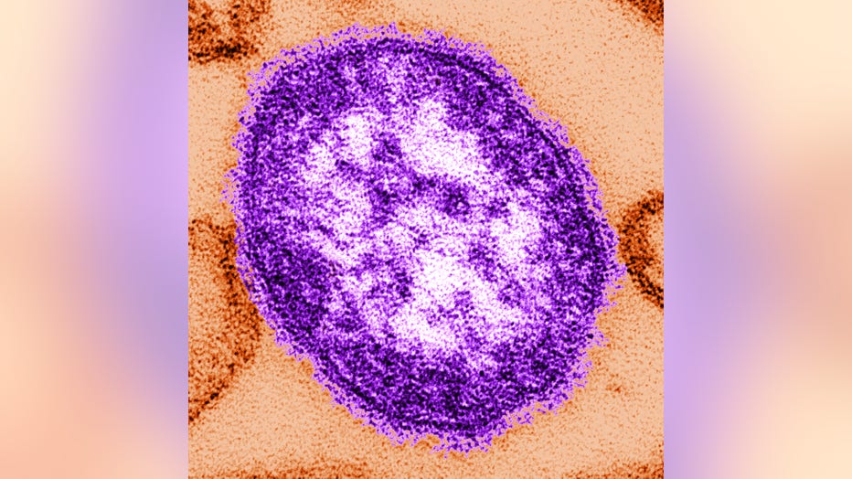 Measles Outbreaks Spread In U.S.