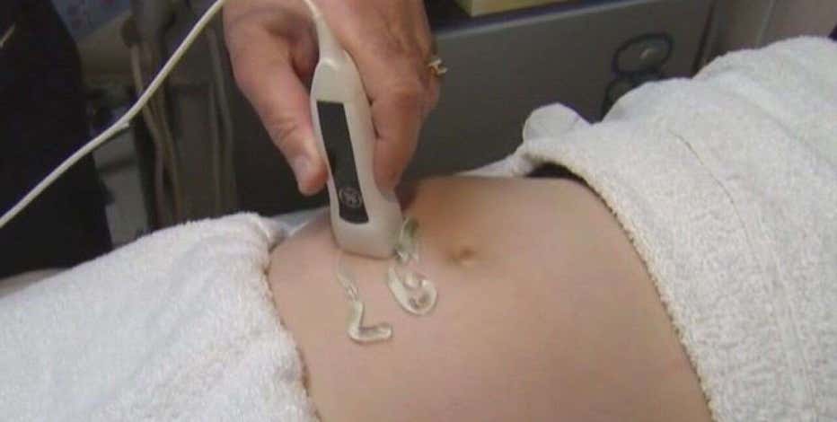 Abortions in Arizona: State can enforce 1864 law, supreme court rules