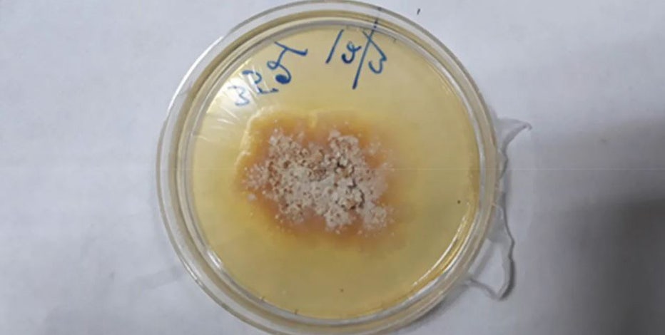 Dangerous plant fungus infects man in first-known global case