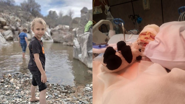 Prescott boy recovering after suffering serious burns in bonfire accident