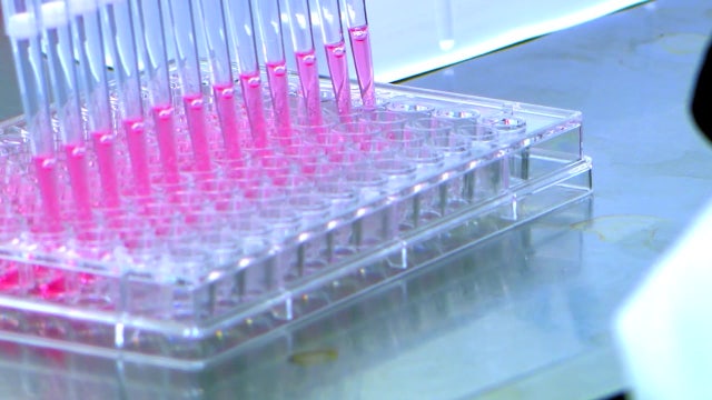 Alzheimer's Disease: UArizona researchers using AI technology to spot and treat the illness