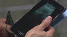 Ultrasound technology becoming so advanced it can be used in emergencies outside a hospital, doctor's office