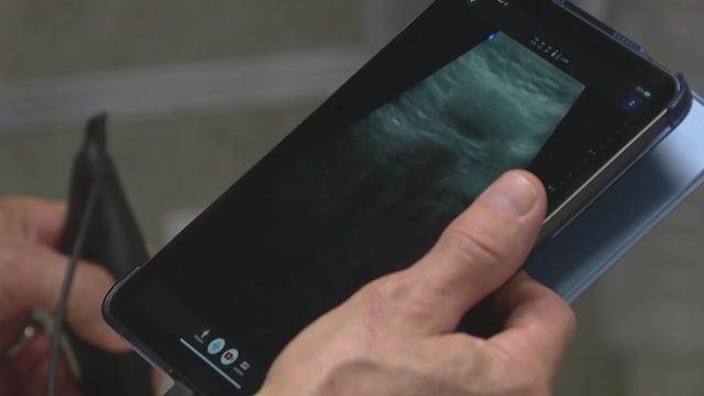Ultrasound technology becoming so advanced it can be used in emergencies outside a hospital, doctor's office