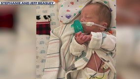 Scottsdale couple's twins born months apart; one remains in NICU