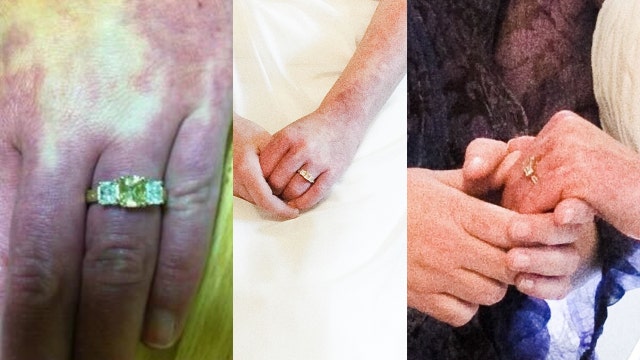 Phoenix visitor loses wedding ring, band at Sky Harbor. Have you seen them?
