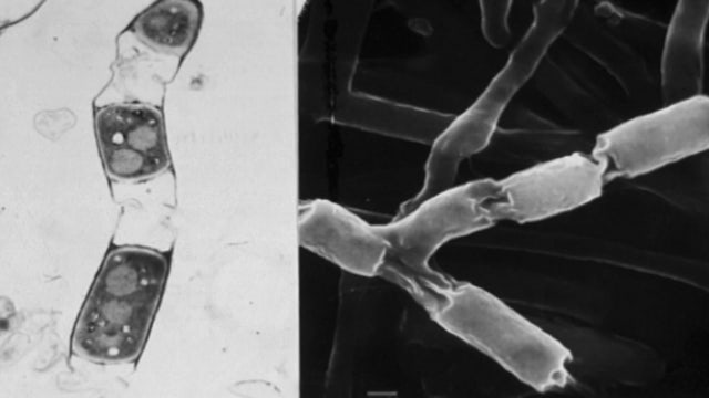 UArizona researcher says it's Valley Fever season in Arizona