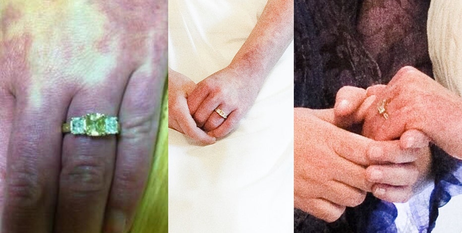 Phoenix visitor loses wedding ring, band at Sky Harbor
