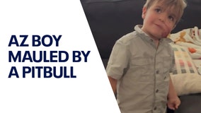 Arizona mom speaks out after young son was mauled by pitbull