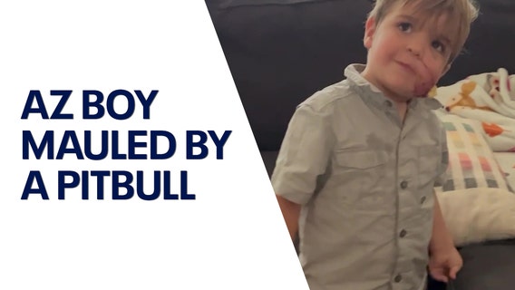 Arizona mom speaks out after young son was mauled by pitbull