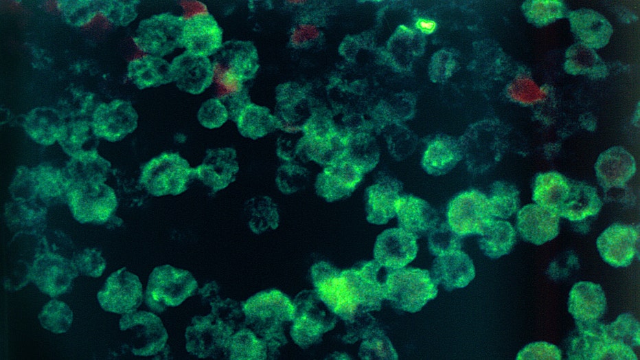 Under a magnification of 630X, and implementing a the direct fluorescent antibody (DFA) staining technique, this photomicrograph depicts histopathologic characteristics associated with a case of amebic meningoencephalitis due to Naegleria fowleri parasites. (Photo by Smith Collection/Gado/Getty Images)