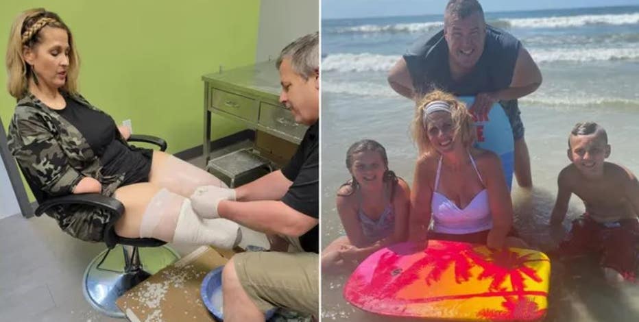 Ohio woman who lost all four limbs to flu complications speaks out to raise awareness