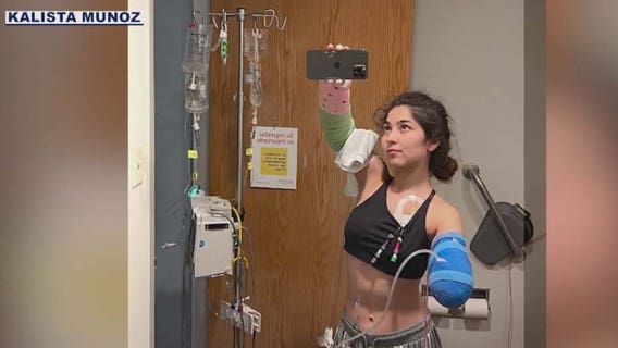 Phoenix woman loses arm in dog attack and needs help paying for a prosthetic