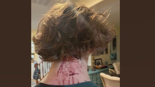 Arizona brass knuckles ban proposed by teen and his mom after Gilbert In-N-Out attack