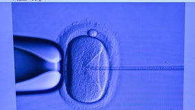 IVF: Alabama high court's embryo ruling leaves some families worried about ripple effects