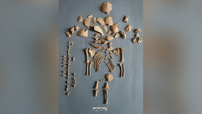 Down syndrome identified in prehistoric bones of infants through DNA