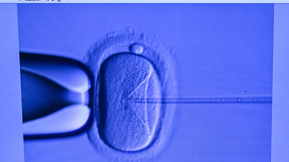 In a laboratory, an electron microscope is used to fertilize an egg cell. (Photo by Jens Kalaene/picture alliance via Getty Images)