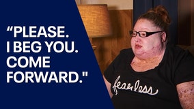 Arizona acid attack victim chooses to forgive suspect, but is still searching for justice