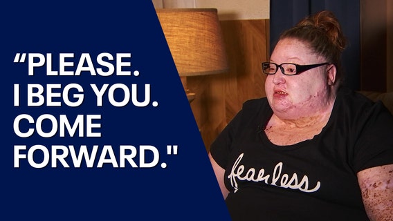 Arizona acid attack victim chooses to forgive suspect, but is still searching for justice