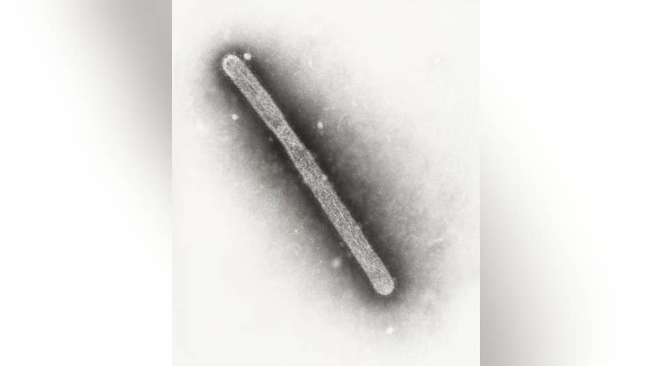 The virion for H5N1, as seen under an electron microscope. (Courtesy: CDC)