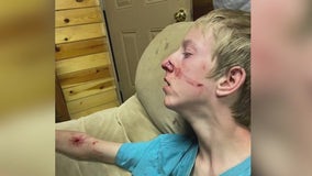 Family comes to rescue of 15-year-old attacked by a bear in Alpine