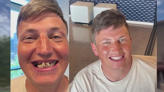 Arizona dental non-profit aims to give smiles back to people struggling with addiction