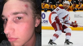 Phoenix assault victim says suspect was the same person who attacked Paul Bissonnette