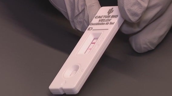 Valley fever test: Patient calls new technology 'life-changing'