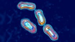1 person dies of the plague in northern Arizona