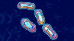 1 person dies of the Plague in northern Arizona