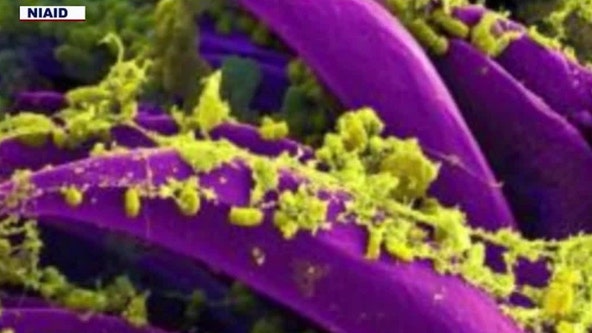 Officials address concerns after AZ plague death