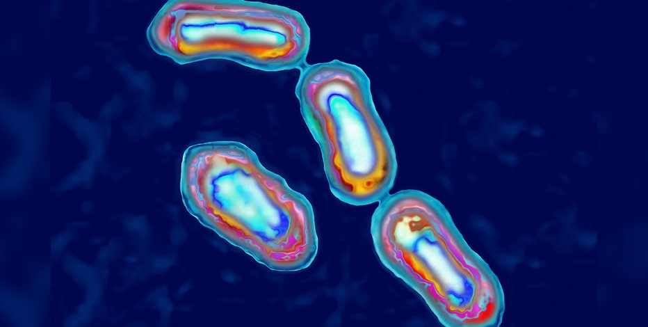 1 person dies of the plague in northern Arizona
