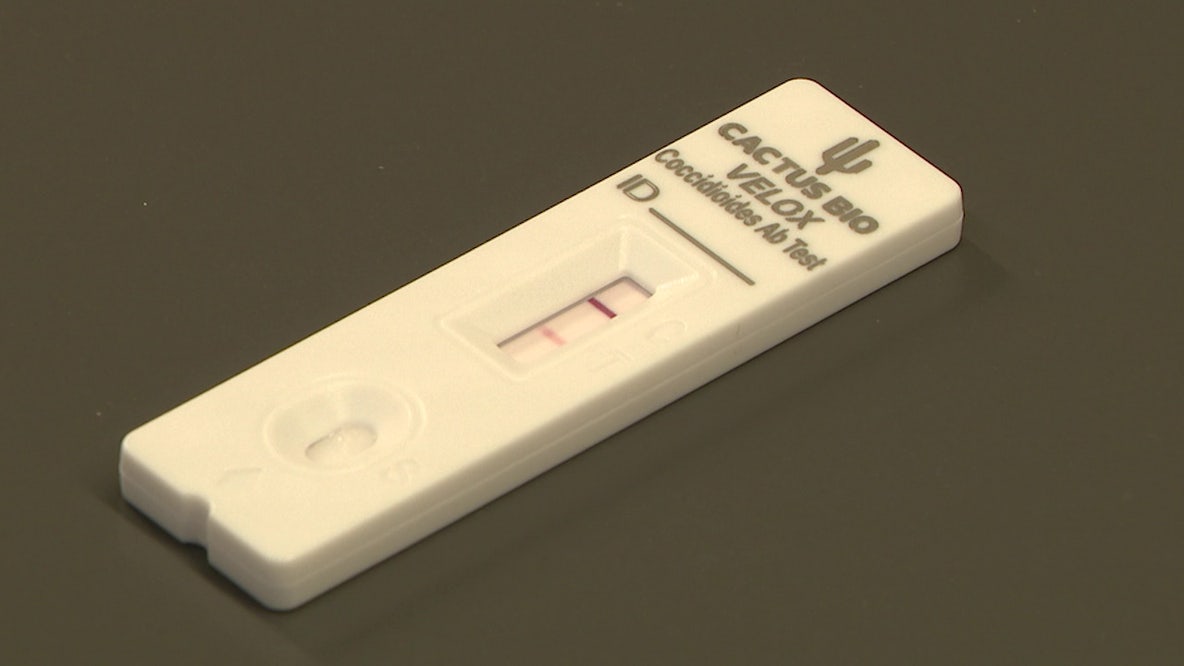 Valley Fever: ASU, Mayo Clinic collab on new test