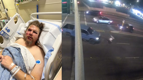 Glendale veteran still recovering from injuries sustained in hit-and-run