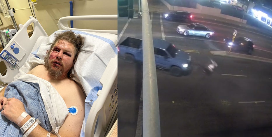 Glendale veteran still recovering from injuries sustained in hit-and-run