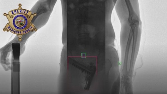 MCSO unveils body scanners to curb jail contraband