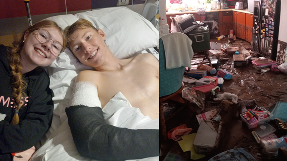 Teen saves family from Globe flood, severely injuring arm in the process