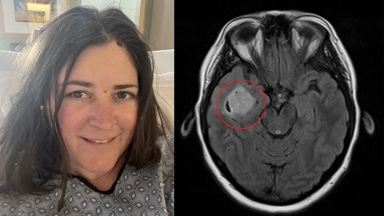 Prenuvo full-body MRI detects woman's brain tumor