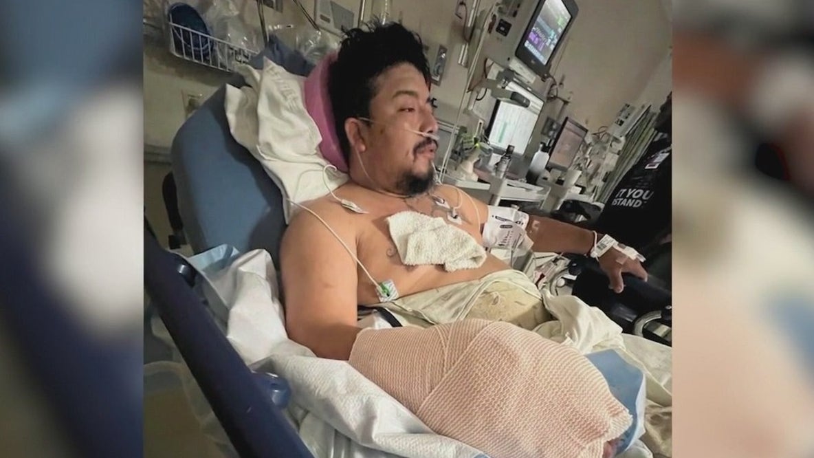 Valley Fever infection leads to man's arm amputation