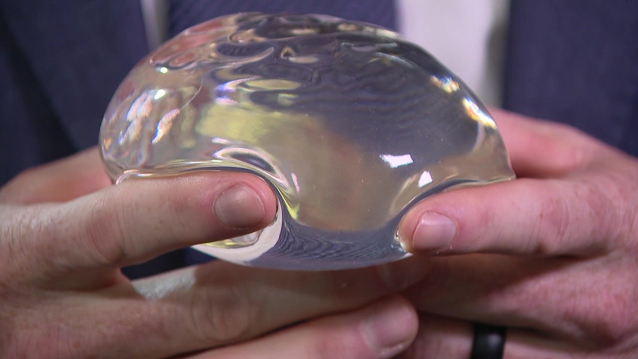 Explantation: More women choosing to remove their breast implants
