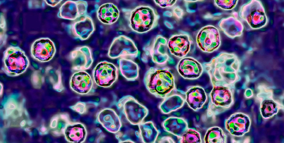 Measles: Maricopa County records 1st case of 2026