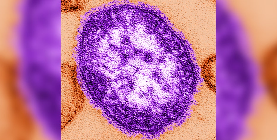Measles: Exposure at Sky Harbor Airport linked to non-resident traveler, says MCDPH