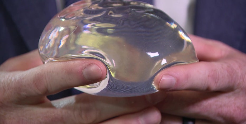 Explantation: More women choosing to remove their breast implants