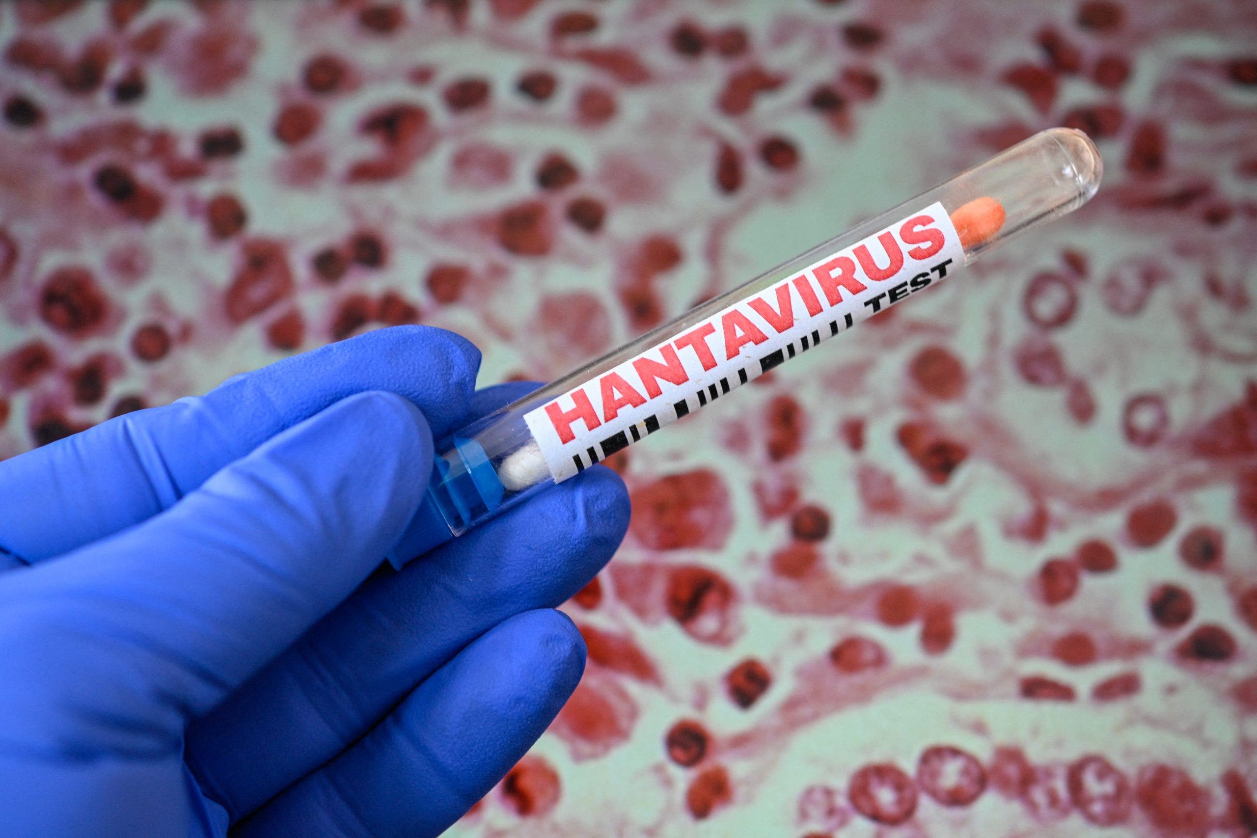 Hantavirus kills Mohave County resident