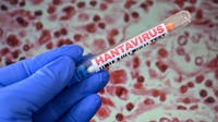 Hantavirus kills Mohave County resident
