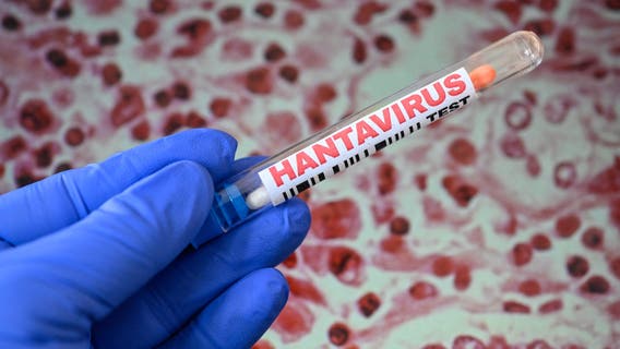 Hantavirus kills Mohave County resident