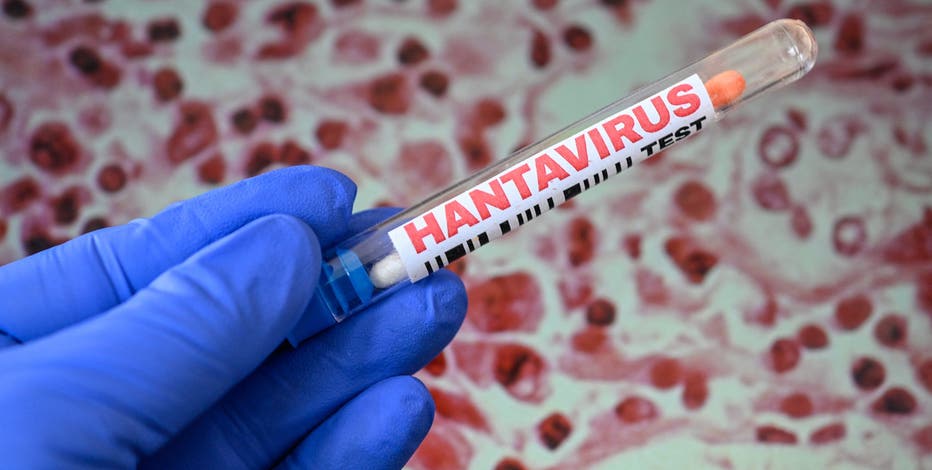 Hantavirus kills Mohave County resident